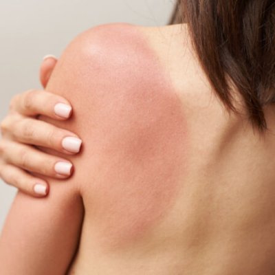 12X WATERWIPES Chusteczki nawilżane Soothing clean 3in1 60 szt. (720 szt.)